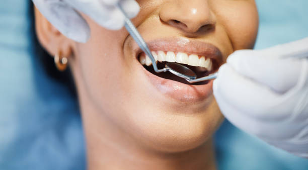 Best Walk-In Emergency Dentist in Oviedo, FL